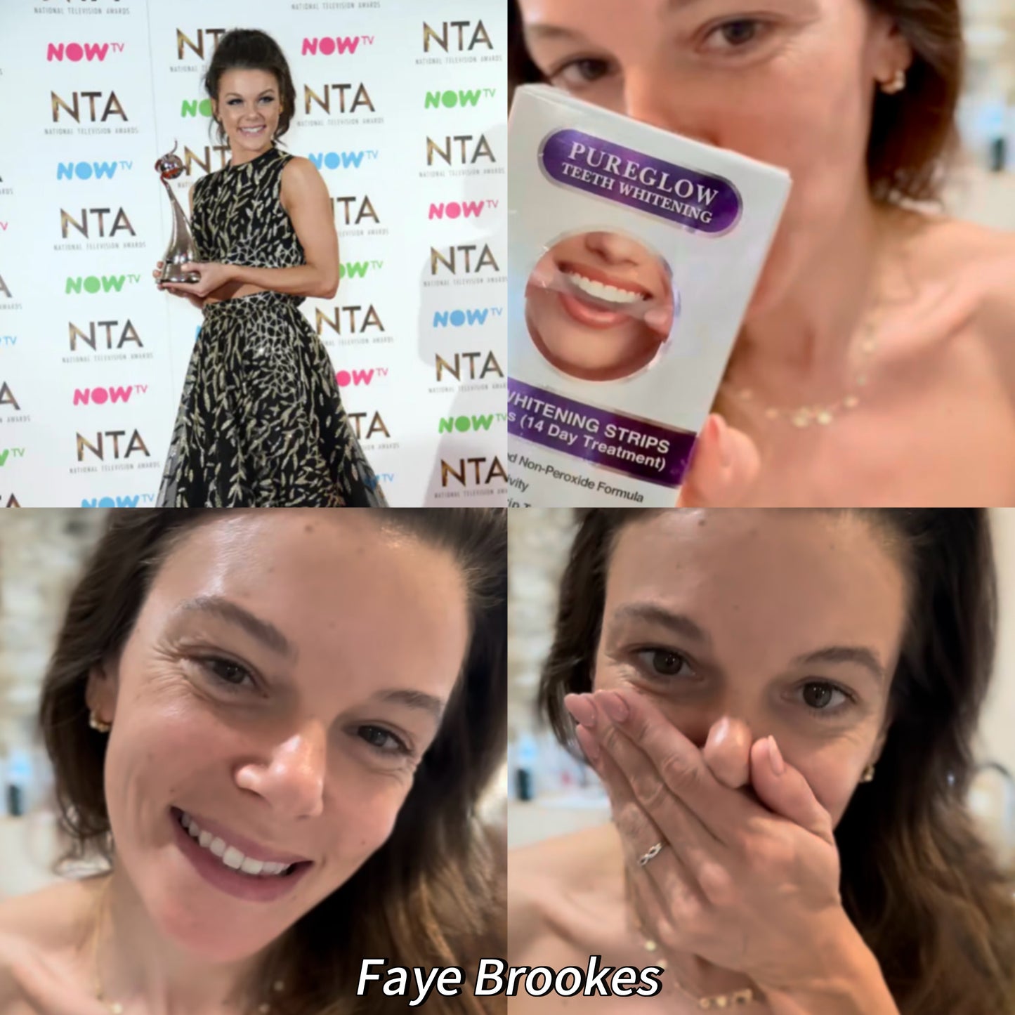 Faye Brookes using PureGlow PAP teeth whitening strips – ex-Coronation Street actress, West End star of Chicago, Legally Blonde, and Grease, showing real results with zero sensitivity whitening, enamel-safe formula, and PureGlow’s money-back guarantee.