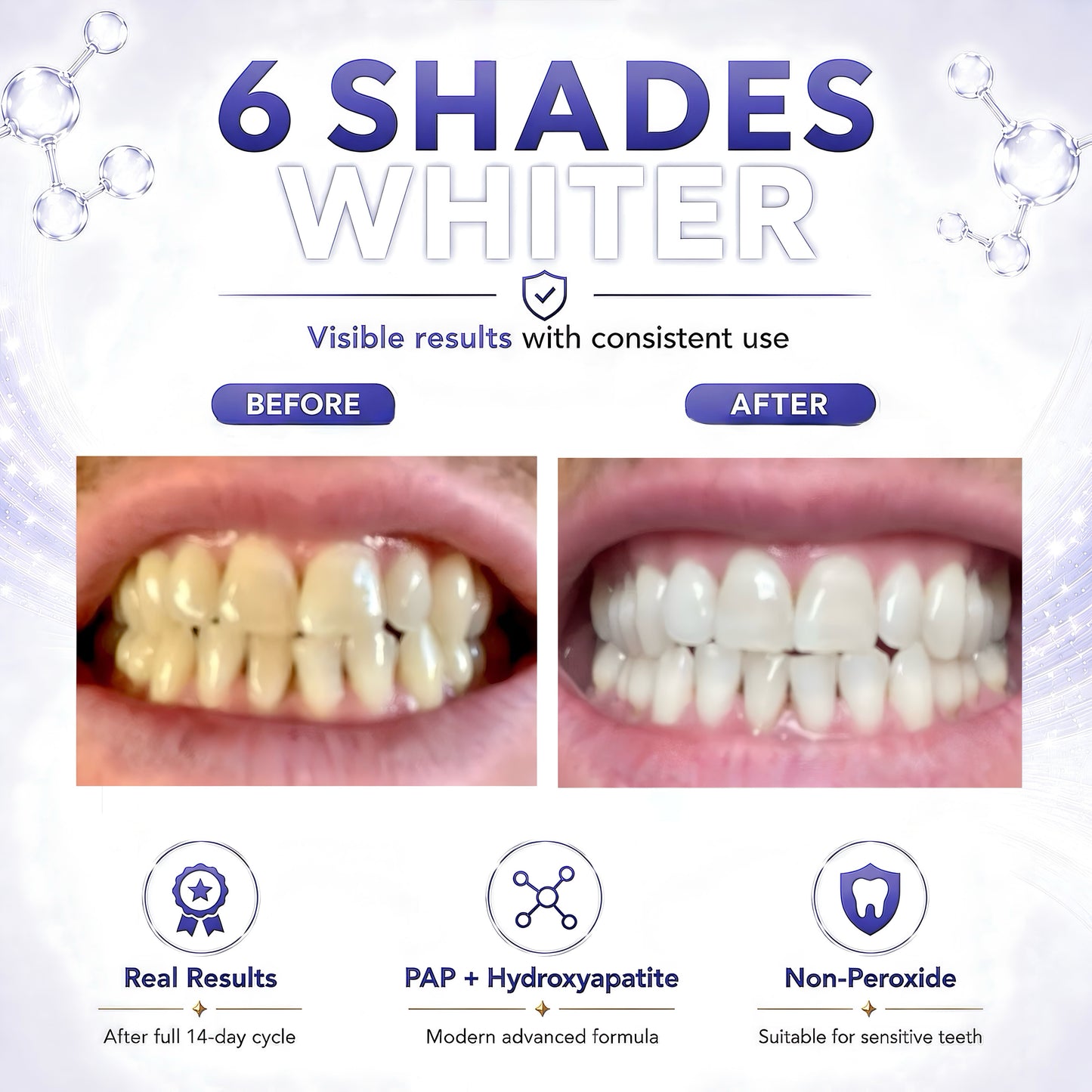 Before and after teeth whitening results using Pure Glow PAP whitening strips, showing visibly whiter teeth after a full 14-day cycle.