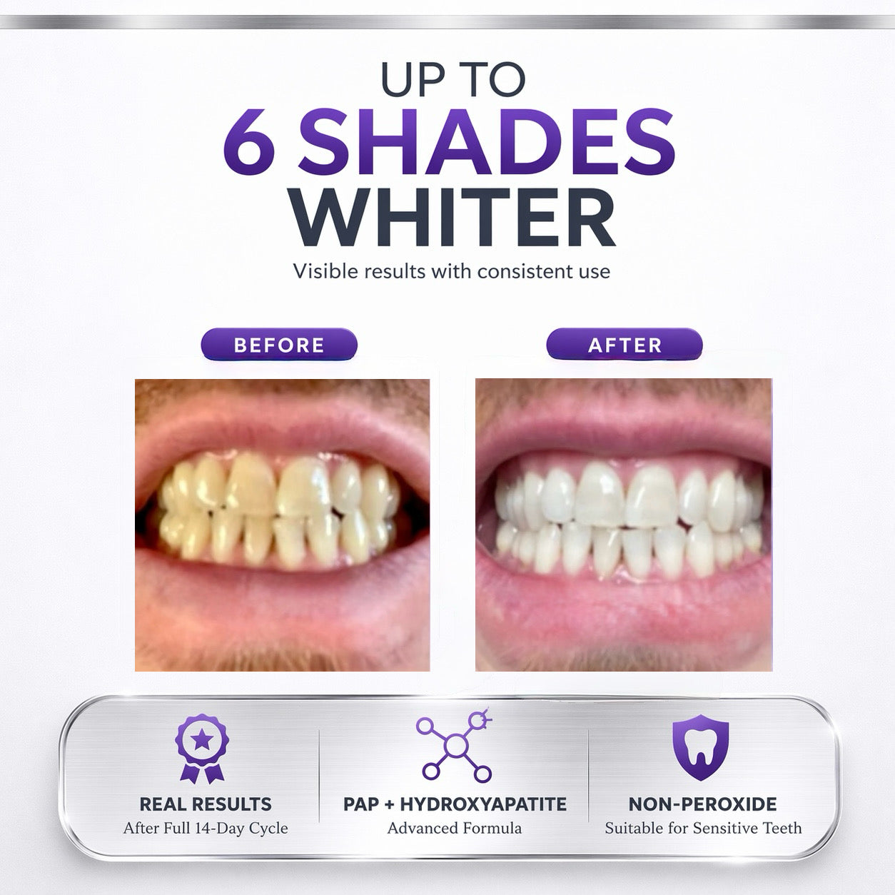 Real results after using Pure Glow Teeth Whitening Strips for 14 days which is the content of one box amazing results done from home.