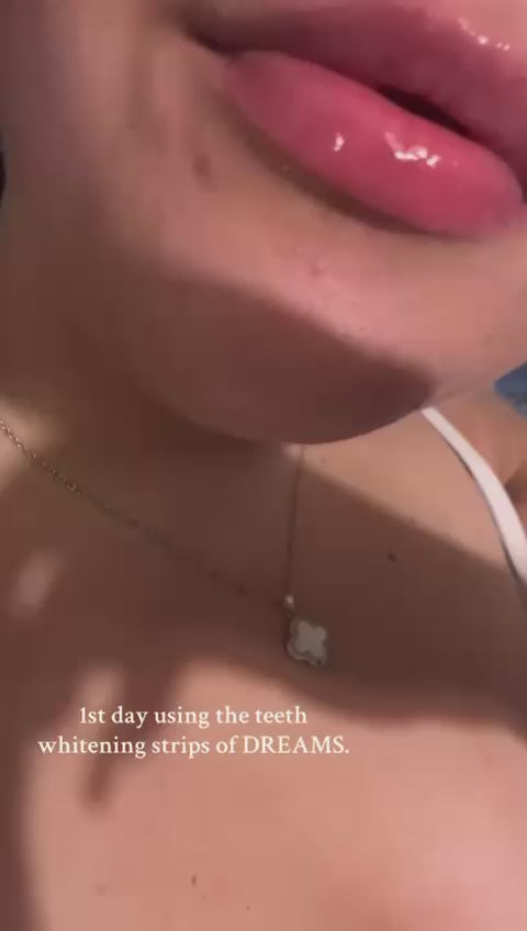 Pure glow teeth whitening 7 day check in after using the zero sensitivity teeth whitening strips